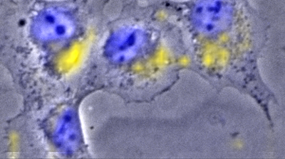 Foto: Verteilung von Europium(III) innerhalb einer Rattennierenzelle, erstmalig sichtbar gemacht mittels chemischer Mikroskopie, eine einzigartige Kopplung von Raman-Mikroskopie und Lumineszenzspektroskopie. ©Copyright: HZDR